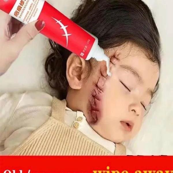 CREME PARA ACNE E CICATRIZES - Imagem 1