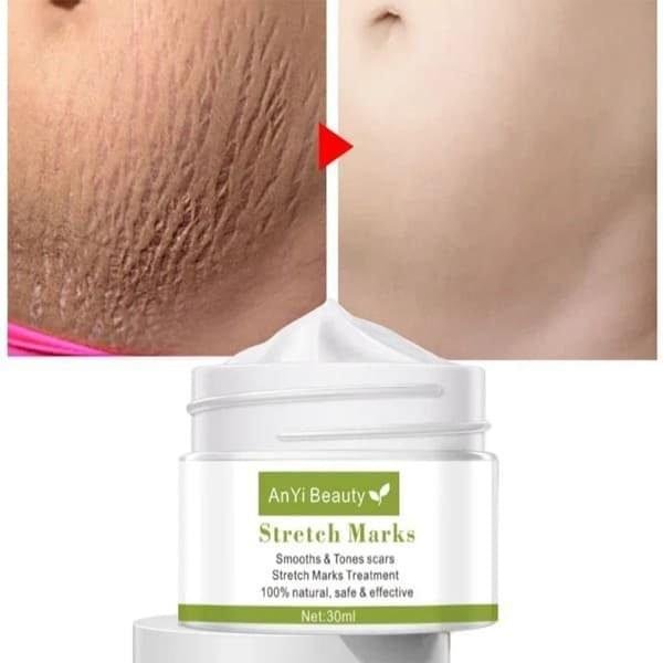 Creme-Anti-estrias-rugas-e-envelhecimento.jpg Creme Anti-estrias, rugas e envelhecimento - Imagem 1